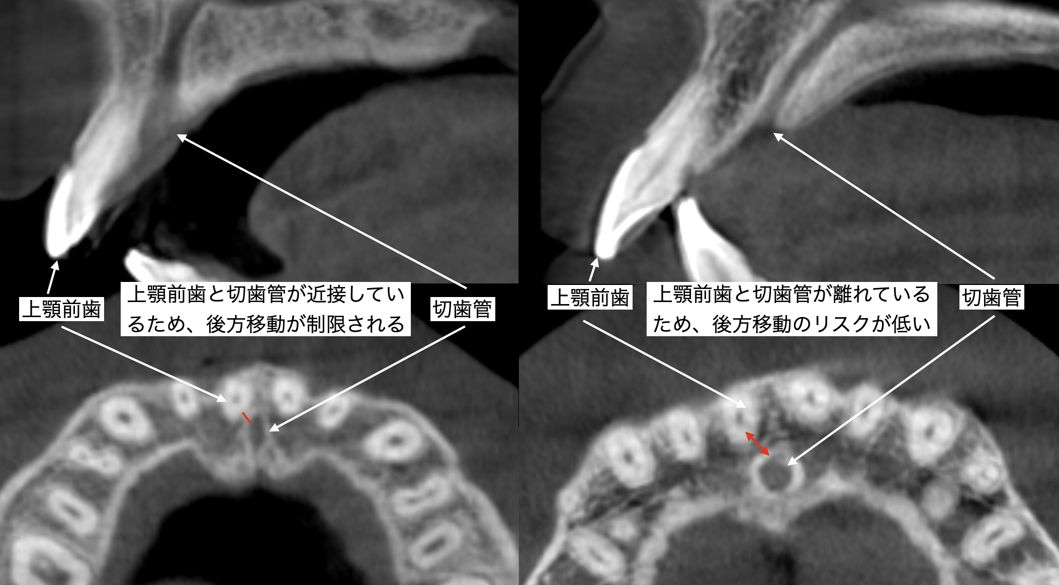 診断と治療計画 | 横浜の矯正歯科はSYNC横浜元町矯正歯科